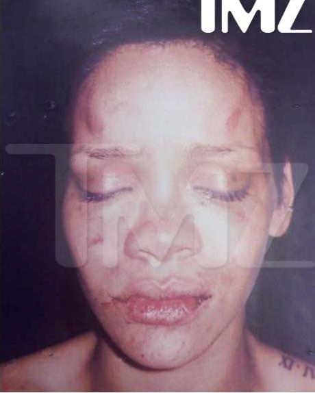 Rihanna Beat up from the Feet up First of all Who cares